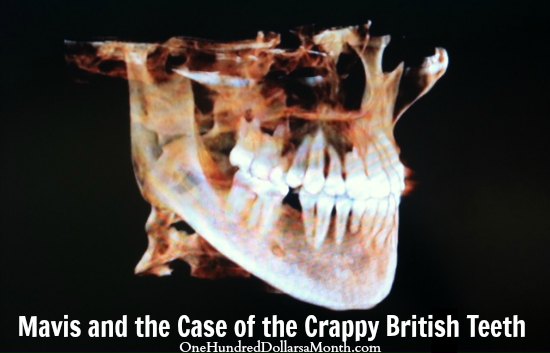 Mavis and the Case of the Crappy British Teeth